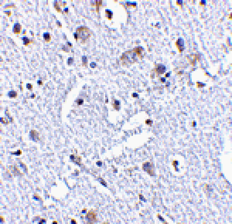 Immunohistochemistry - TIGAR Antibody from Signalway Antibody (24500) - Antibodies.com