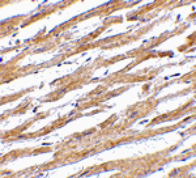 Immunohistochemistry - PDL-1 Antibody from Signalway Antibody (24503) - Antibodies.com