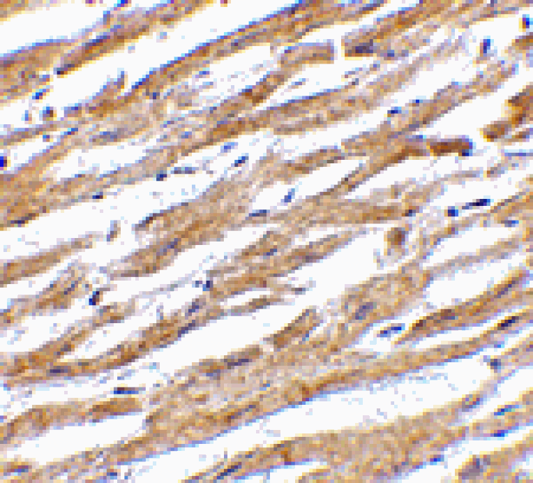 Immunohistochemistry - PDL-1 Antibody from Signalway Antibody (24503) - Antibodies.com
