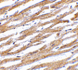 Immunohistochemistry - PDL-1 Antibody from Signalway Antibody (24503) - Antibodies.com