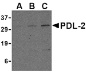 Western blot - PDL-2 Antibody from Signalway Antibody (24504) - Antibodies.com