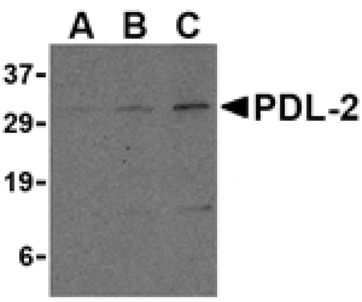 Western blot - PDL-2 Antibody from Signalway Antibody (24504) - Antibodies.com