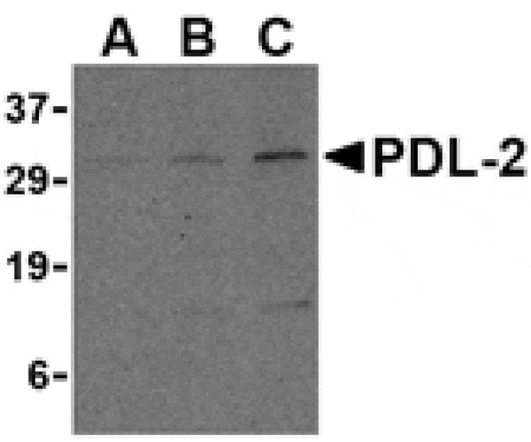 Western blot - PDL-2 Antibody from Signalway Antibody (24504) - Antibodies.com