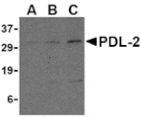 Western blot - PDL-2 Antibody from Signalway Antibody (24504) - Antibodies.com