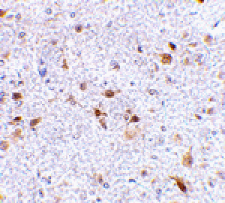 Immunohistochemistry - PDL-2 Antibody from Signalway Antibody (24504) - Antibodies.com