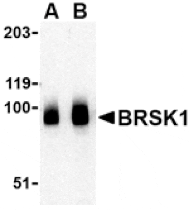 Western blot - BRSK1 Antibody from Signalway Antibody (24512) - Antibodies.com