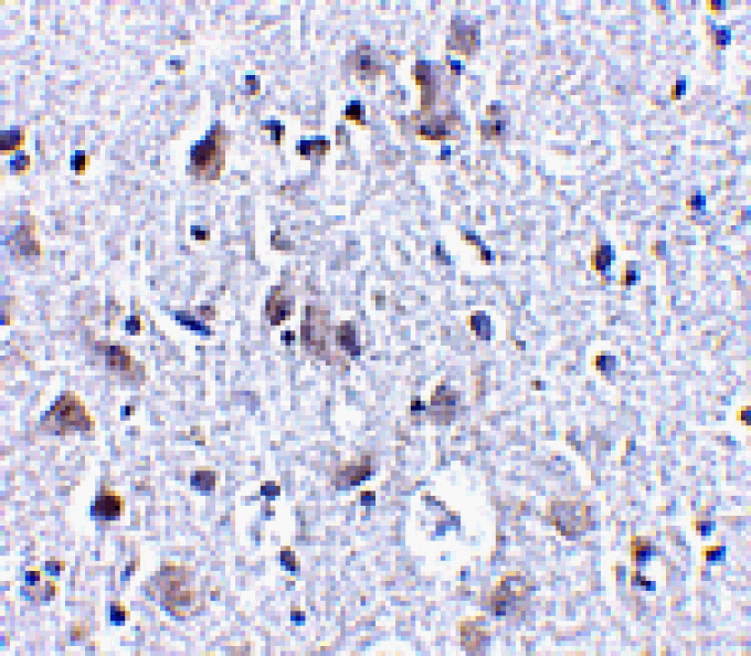 Immunohistochemistry - BRSK1 Antibody from Signalway Antibody (24512) - Antibodies.com
