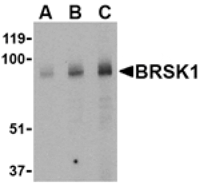 Western blot - BRSK1 Antibody from Signalway Antibody (24513) - Antibodies.com