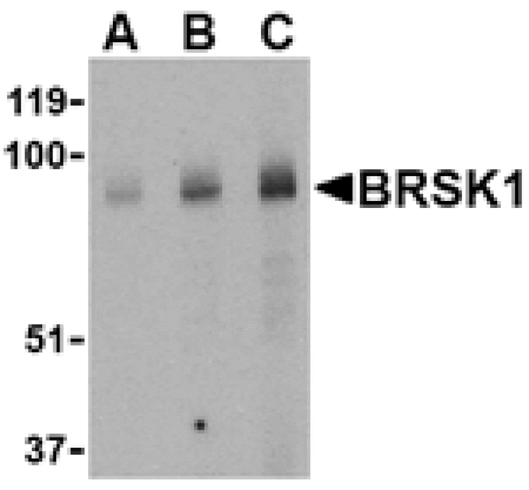 Western blot - BRSK1 Antibody from Signalway Antibody (24513) - Antibodies.com