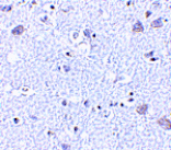 Immunohistochemistry - BRSK1 Antibody from Signalway Antibody (24513) - Antibodies.com