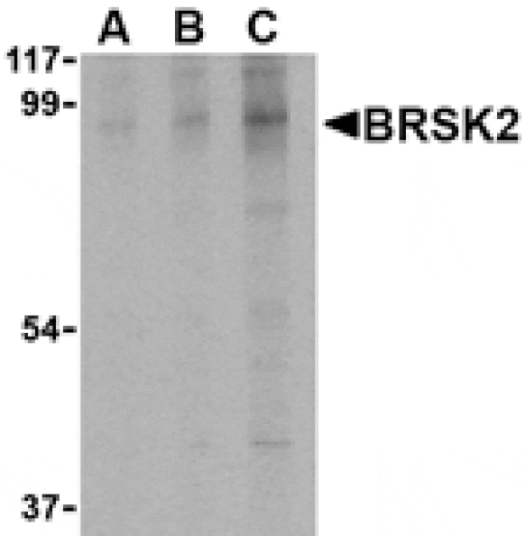 Western blot - BRSK2 Antibody from Signalway Antibody (24514) - Antibodies.com