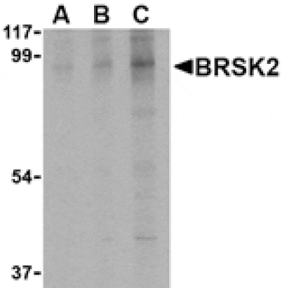 Western blot - BRSK2 Antibody from Signalway Antibody (24514) - Antibodies.com