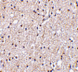 Immunohistochemistry - BRSK2 Antibody from Signalway Antibody (24514) - Antibodies.com