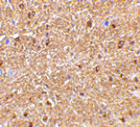 Immunohistochemistry - NogoA Antibody from Signalway Antibody (24515) - Antibodies.com