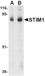 Western blot - STIM1 Antibody from Signalway Antibody (24523) - Antibodies.com