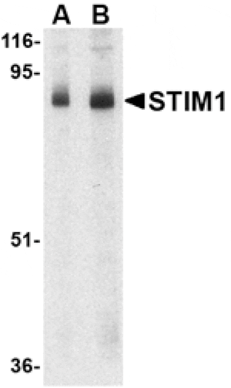 Western blot - STIM1 Antibody from Signalway Antibody (24523) - Antibodies.com