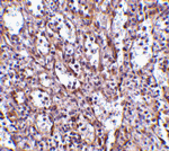 Immunohistochemistry - STIM1 Antibody from Signalway Antibody (24523) - Antibodies.com