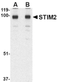 Western blot - STIM2 Antibody from Signalway Antibody (24524) - Antibodies.com