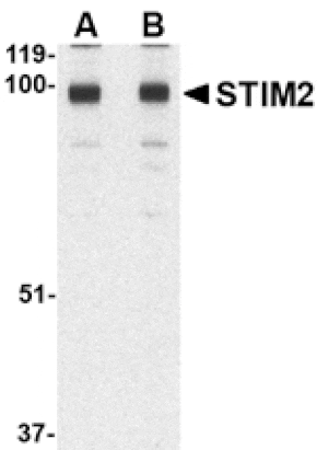 Western blot - STIM2 Antibody from Signalway Antibody (24524) - Antibodies.com
