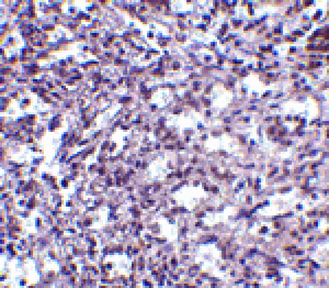 Immunohistochemistry - STIM2 Antibody from Signalway Antibody (24524) - Antibodies.com