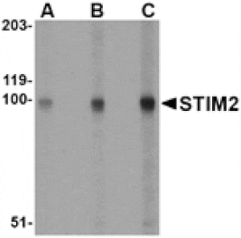 Western blot - STIM2 Antibody from Signalway Antibody (24525) - Antibodies.com