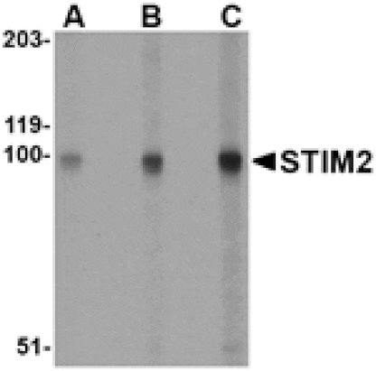 Western blot - STIM2 Antibody from Signalway Antibody (24525) - Antibodies.com