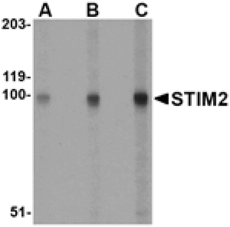 Western blot - STIM2 Antibody from Signalway Antibody (24525) - Antibodies.com