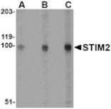 Western blot - STIM2 Antibody from Signalway Antibody (24525) - Antibodies.com