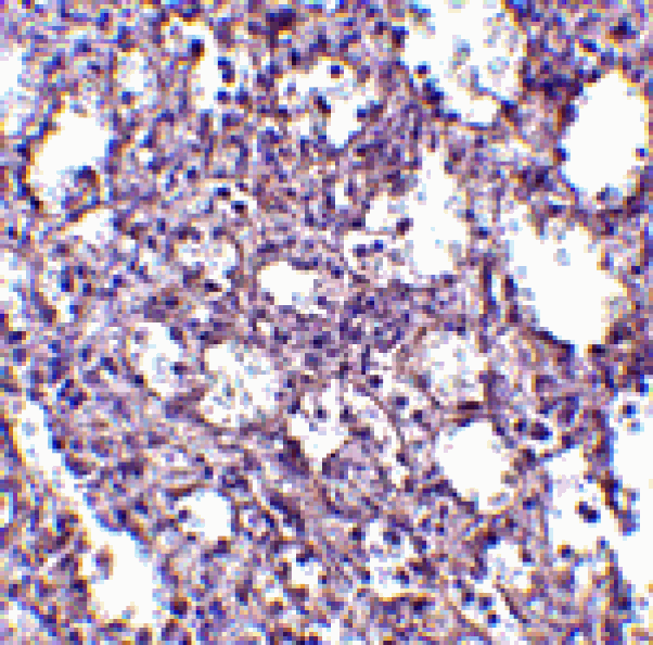 Immunohistochemistry - STIM2 Antibody from Signalway Antibody (24525) - Antibodies.com