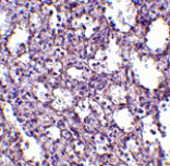 Immunohistochemistry - STIM2 Antibody from Signalway Antibody (24525) - Antibodies.com