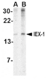 Western blot - IEX-1 Antibody from Signalway Antibody (24541) - Antibodies.com