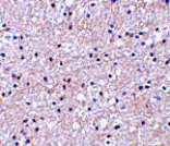 Immunohistochemistry - IEX-1 Antibody from Signalway Antibody (24541) - Antibodies.com