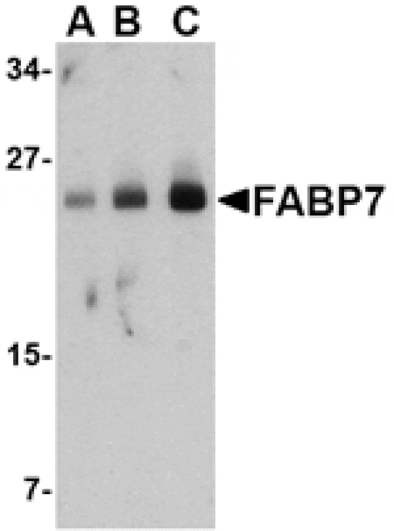 Western blot - FABP7 Antibody from Signalway Antibody (24545) - Antibodies.com