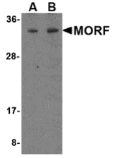Western blot analysis of MORF4 in K562 cell lysate with MORF4 antibody at (A) 1 and (B) 2 µg/mL.