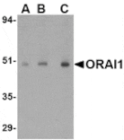 Western blot - ORAI1 Antibody from Signalway Antibody (24555) - Antibodies.com