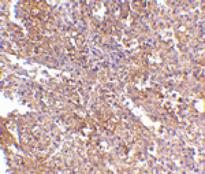 Immunohistochemistry - RAP80 Antibody from Signalway Antibody (24573) - Antibodies.com