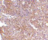 Immunohistochemistry - RAP80 Antibody from Signalway Antibody (24573) - Antibodies.com