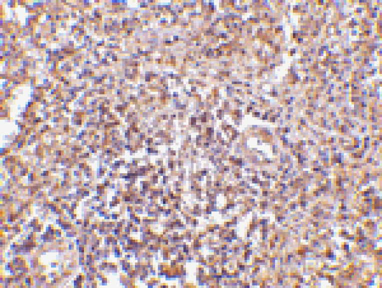 Immunohistochemistry - RAP80 Antibody from Signalway Antibody (24574) - Antibodies.com