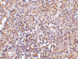 Immunohistochemistry - RAP80 Antibody from Signalway Antibody (24574) - Antibodies.com