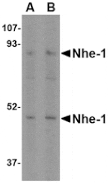 Western blot - Nhe-1 Antibody from Signalway Antibody (24598) - Antibodies.com