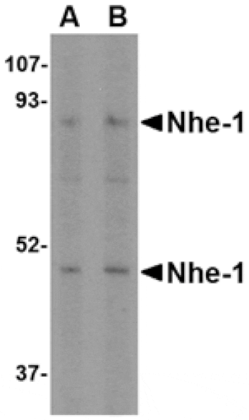 Western blot - Nhe-1 Antibody from Signalway Antibody (24598) - Antibodies.com
