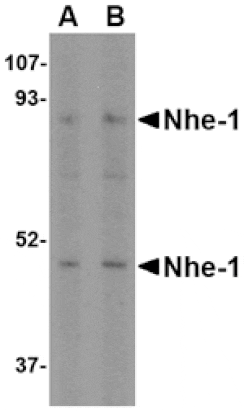 Western blot - Nhe-1 Antibody from Signalway Antibody (24598) - Antibodies.com
