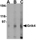 Western blot analysis of Grik4 in rat brain lysate with Grik4 antibody at (A) 0.5 (B) 1 and (C) 2 µg/mL.