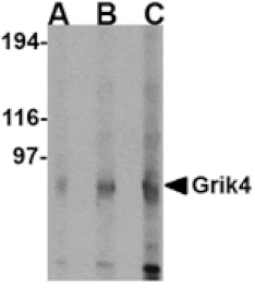 Western blot - Grik4 Antibody from Signalway Antibody (24604) - Antibodies.com