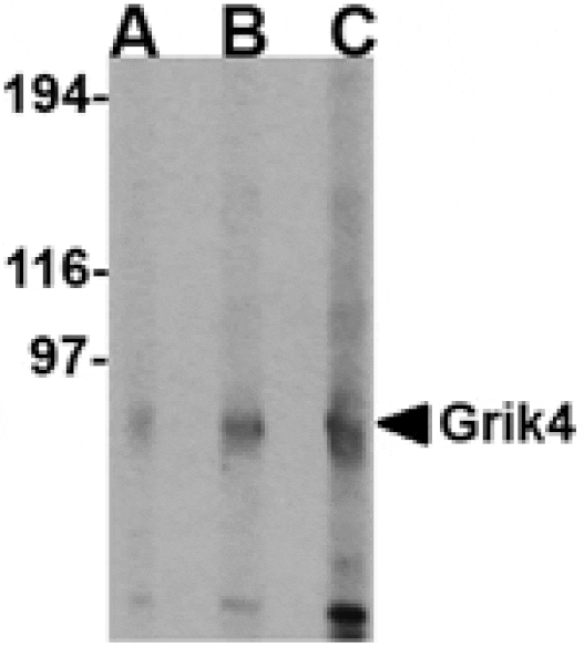 Western blot - Grik4 Antibody from Signalway Antibody (24604) - Antibodies.com
