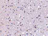 Immunohistochemistry - Grik4 Antibody from Signalway Antibody (24604) - Antibodies.com