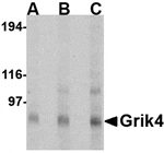 Western blot analysis of Grik4 in Rat brain tissue lysate with Grik4 antibody at (A) 0.5, (B) 1 and (C) 2 µg/mL.
