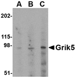 Western blot analysis of Grik5 in human brain tissue lysate with Grik5 antibody at (A) 0.5, (B) 1 and (C) 2 µg/mL.