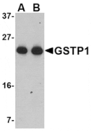 Western blot - GSTP1 Antibody from Signalway Antibody (24614) - Antibodies.com