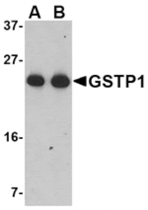 Western blot - GSTP1 Antibody from Signalway Antibody (24614) - Antibodies.com